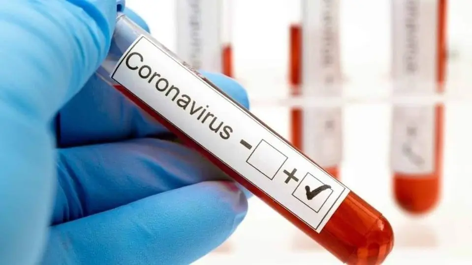 Test de coronavirus.