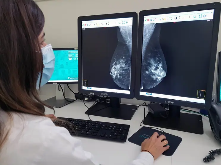 mamograf&iacute;a_quir&oacute;nsalud_campodegibraltar
