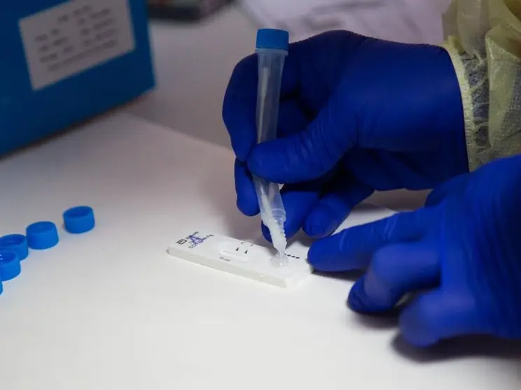 cepa virus