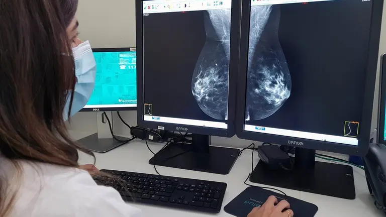 mamograf&iacute;a_quir&oacute;nsalud_campodegibraltar