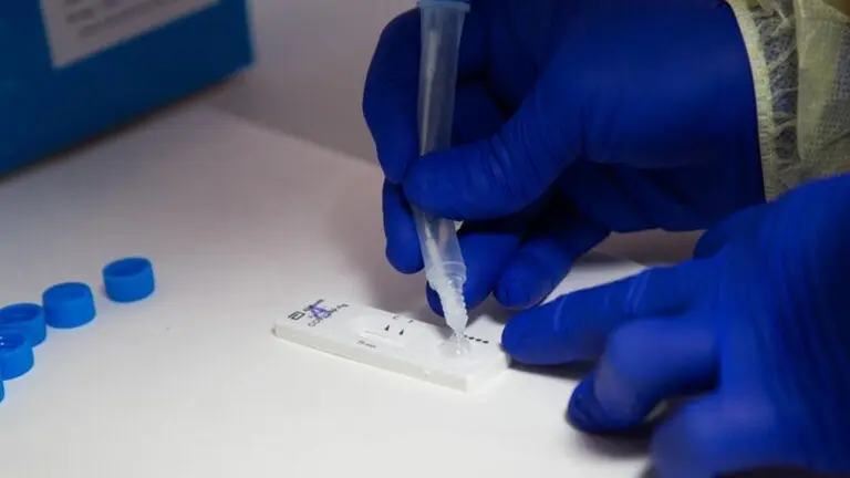 cepa virus